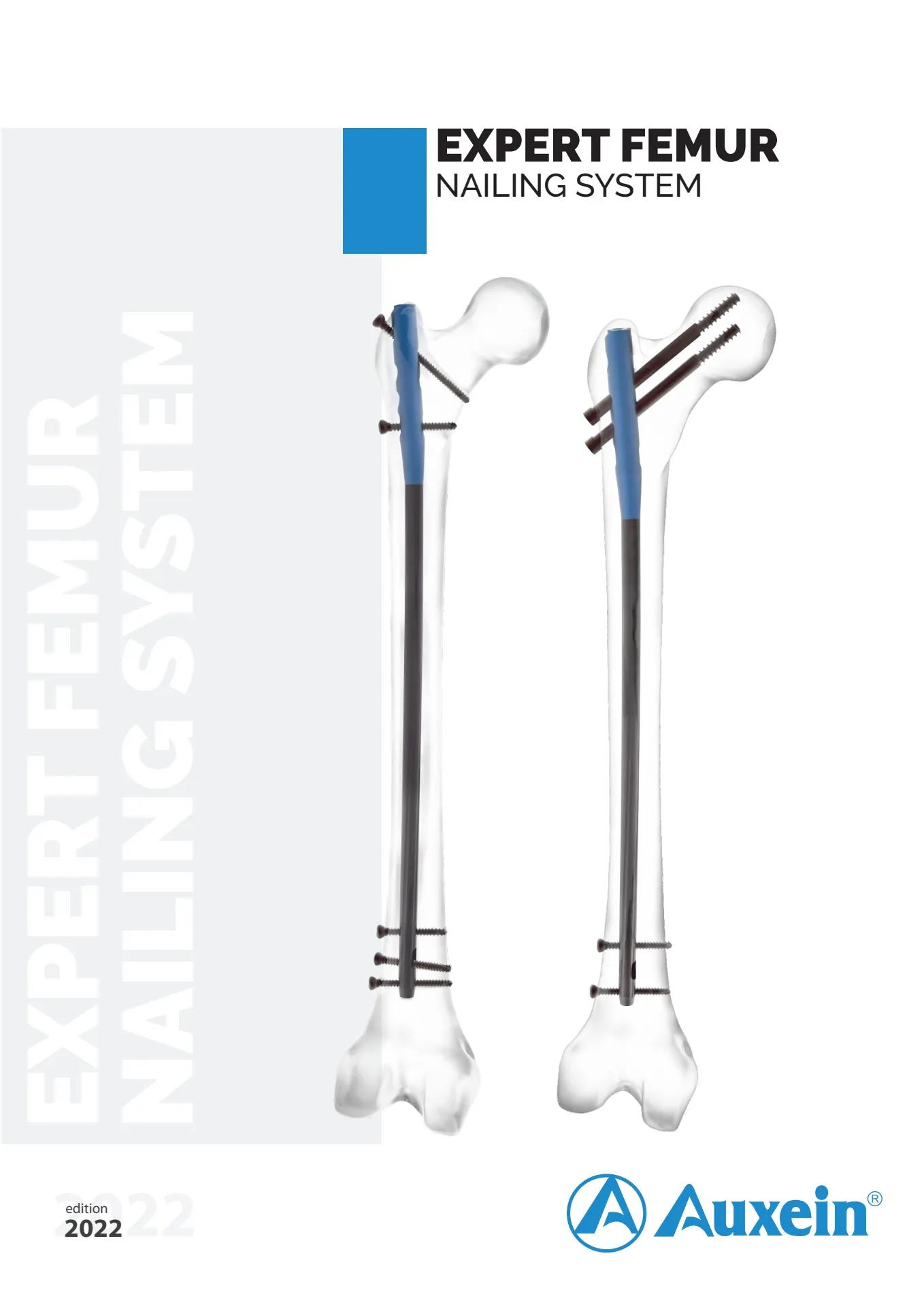 Expert-Femur-Nailing-System
